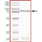 MET (R1227K), Active